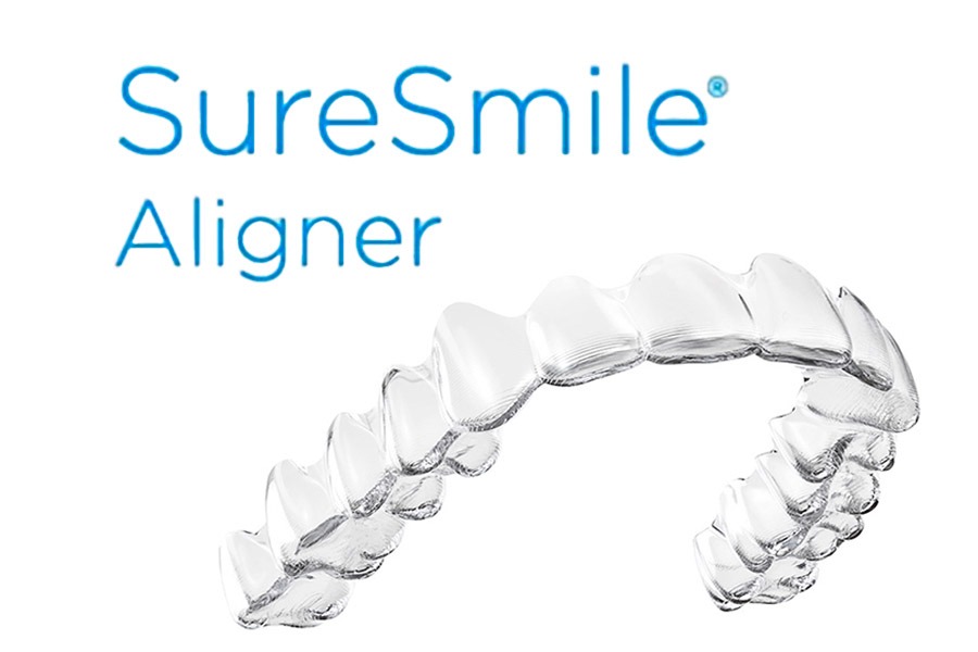 シュアスマイル矯正